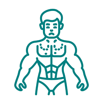 Gynecomastia Surgery (Male Breast Reduction)
