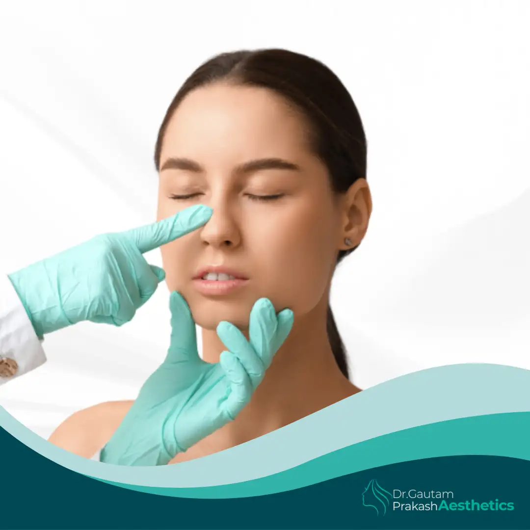 dr gautam prakash Aesthectics Rhinoplasty (Nose Reshaping Surgery)