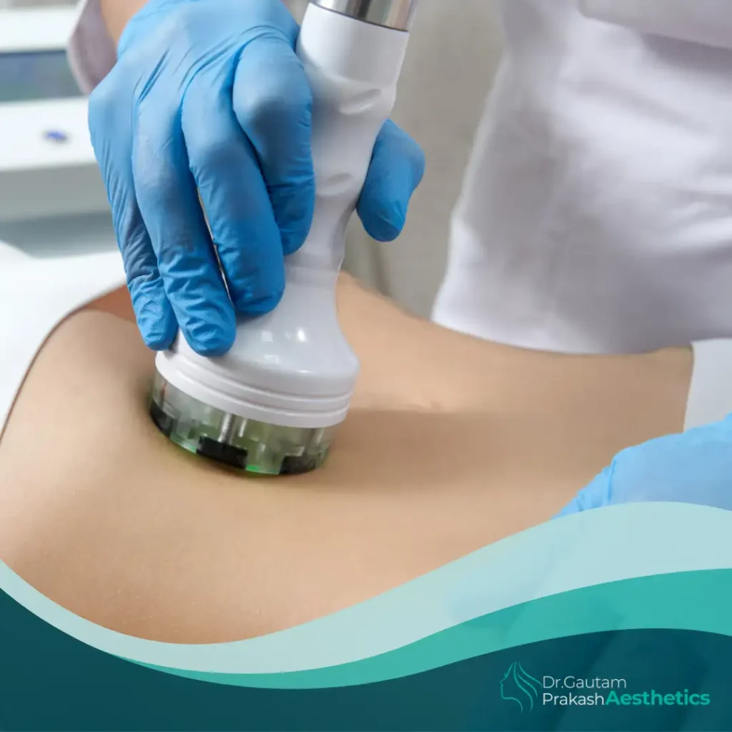 Body Contouring & Fat Reduction Dr Gautam Prakash Aesthetics