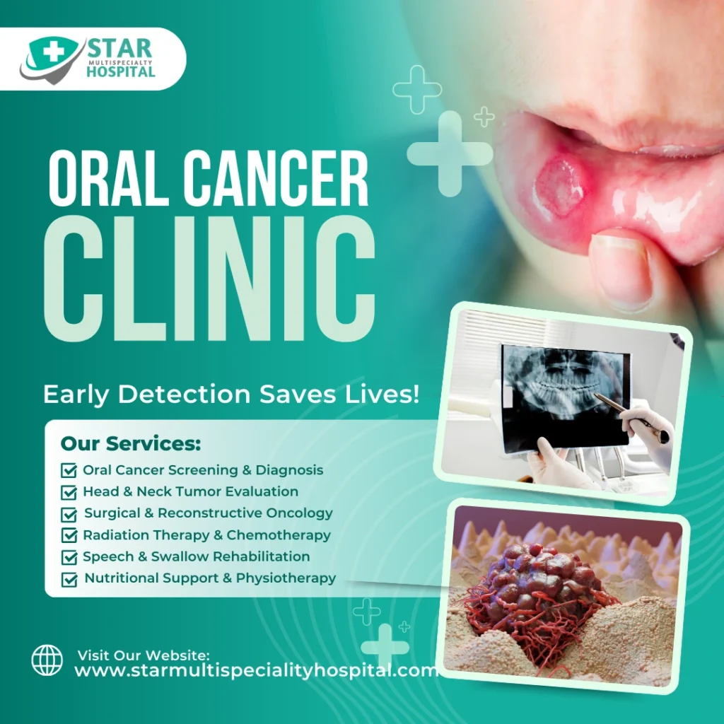 Best Oral Cancer Hospital in Varanasi