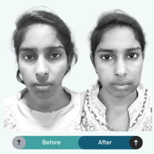 dr gautam prakash plastic surgeon