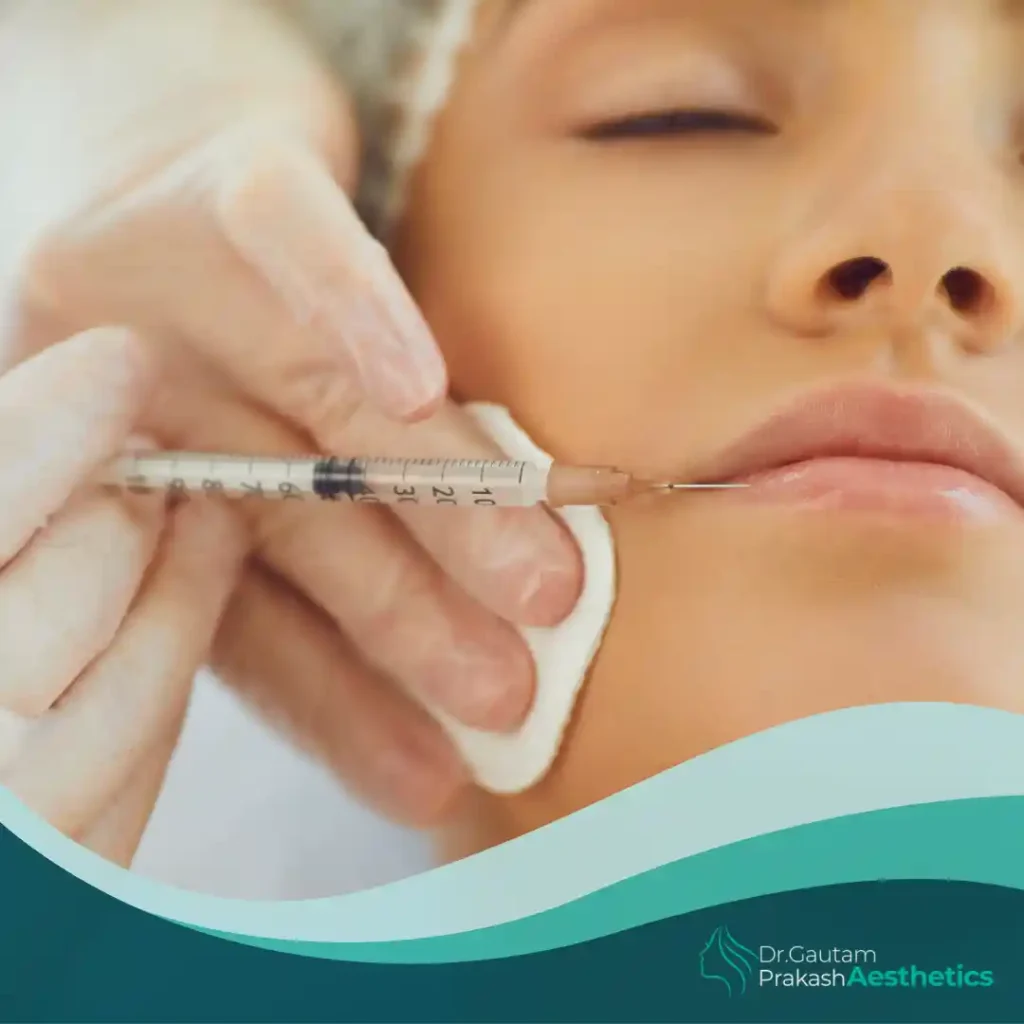 Botox Injections​ filling