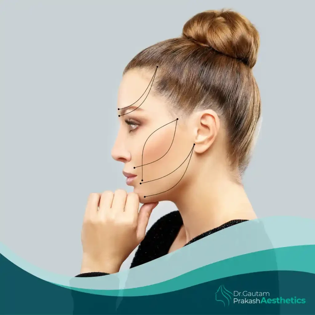 Non-Surgical Face Lift​