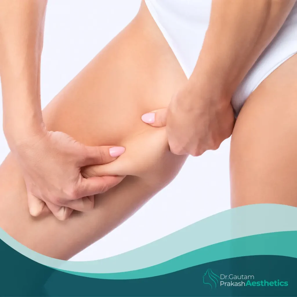 Thigh Lift​ surgery