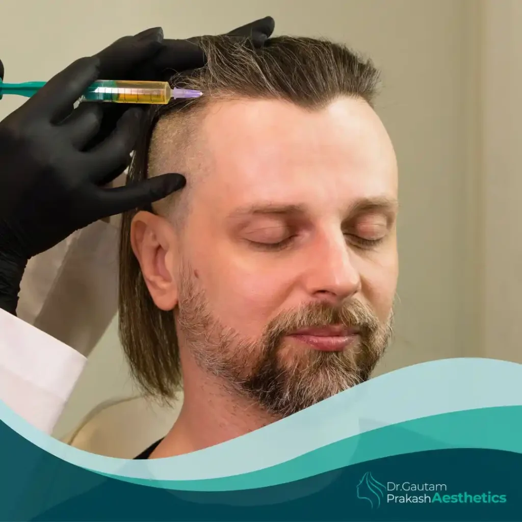 PRP Hair Therapy​