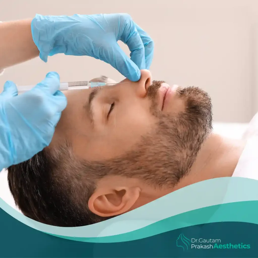 Male Rhinoplasty​ surgery