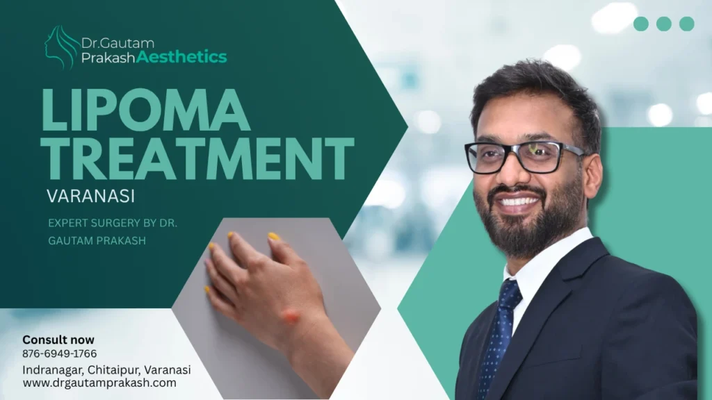 Lipoma Treatment in Varanasi by Dr. Gautam Prakash – Expert Surgical Care for Lasting Relief