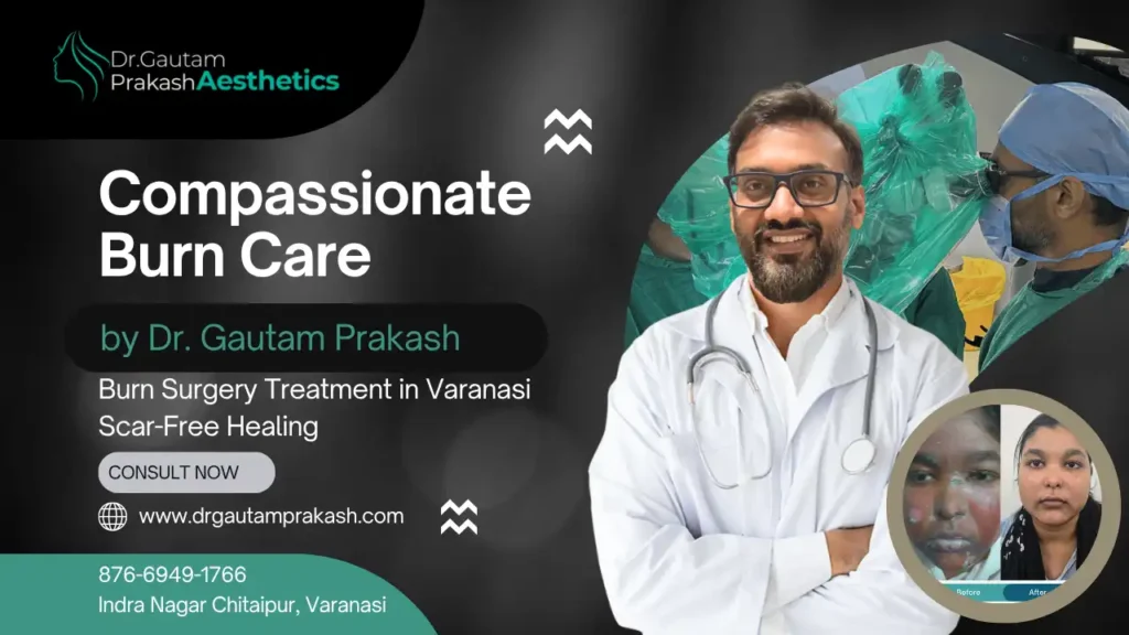 burn surgery treatment in varanasi: Before and after burn treatment images showing scar improvement and skin restoration in Varanasi.