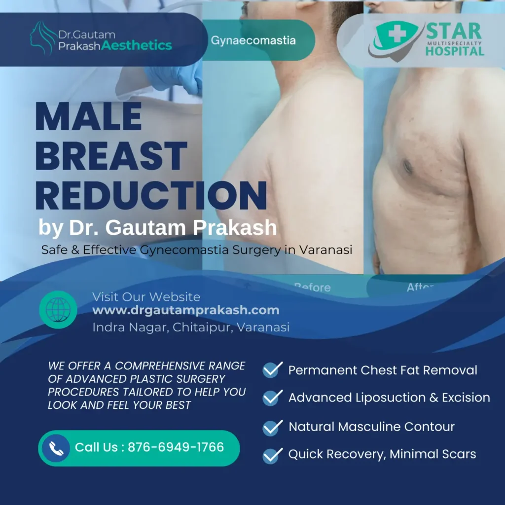 Male Breast Reduction Surgery in Varanasi – Gynecomastia Treatment by Dr. Gautam Prakash