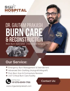 Dr. Gautam Prakash, the Best Burn Specialist Doctor in Varanasi, providing advanced Burn Surgery at Star Hospital.