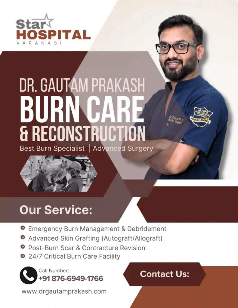 Best Burn Specialist Doctor in Varanasi